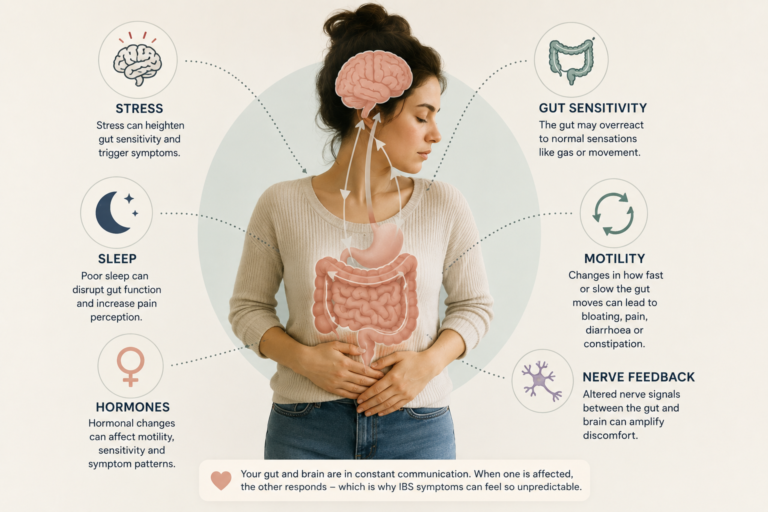 Infographic showing the factors behind unpredictable IBS flares: stress, sleep, hormones, gut sensitivity, motility and nerve feedback in the gut-brain connection